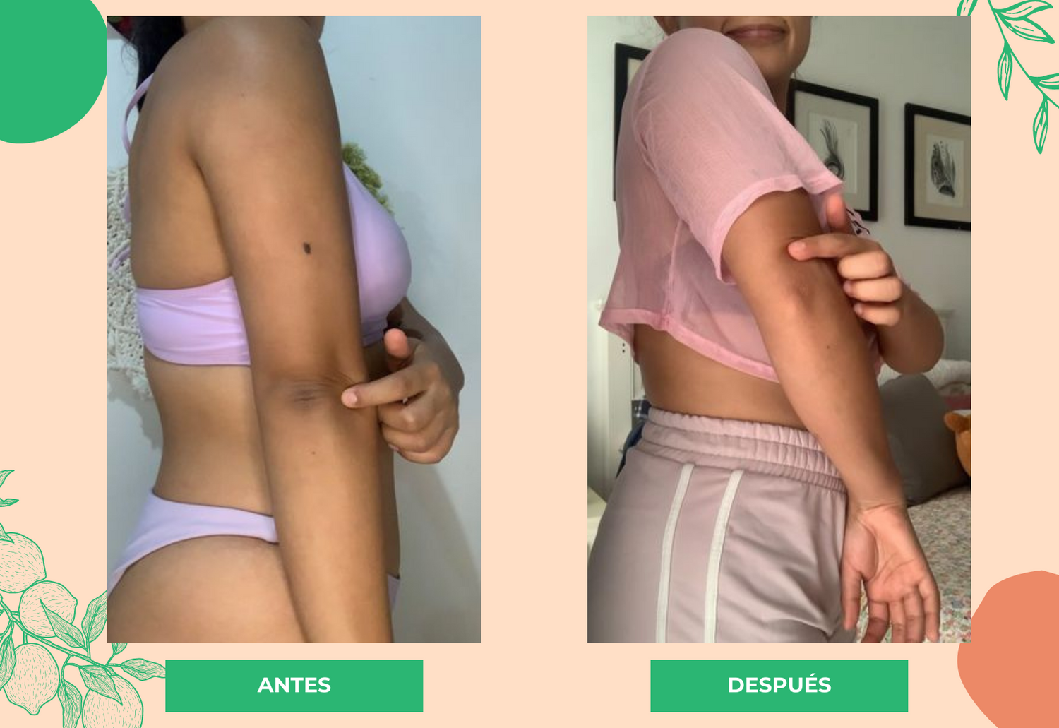 Antes y después de usar Aceite Aurorus donde se ve la piel sin manchas.